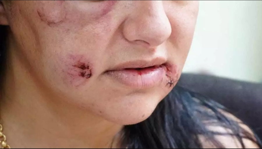 Center feminicidio